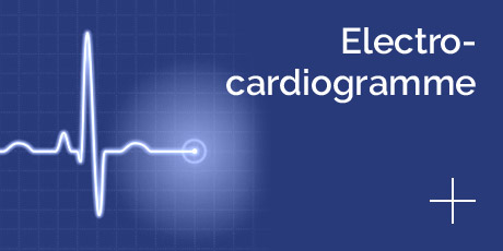 électrocardiogramme