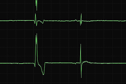 électrocardiogramme, Clinique vétérinaire Hopia Versailles Grand Parc
