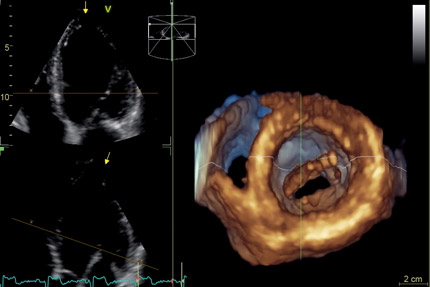 échogramme 4D, Clinique vétérinaire Hopia Versailles Grand Parc
