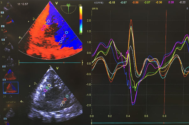 doppler tissulaire, Clinique vétérinaire Hopia Versailles Grand Parc