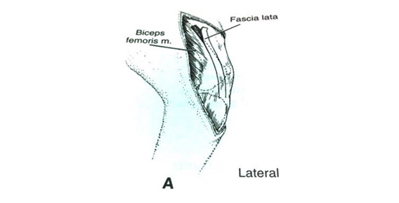 Schéma d'un genou de chien anatomie